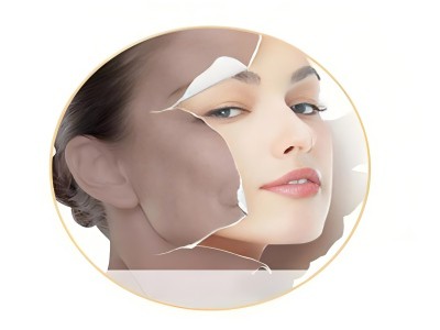 エピタロンの効果と用途とは？