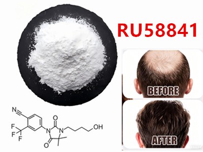 RU58841は脱毛治療の鍵となり得るか?